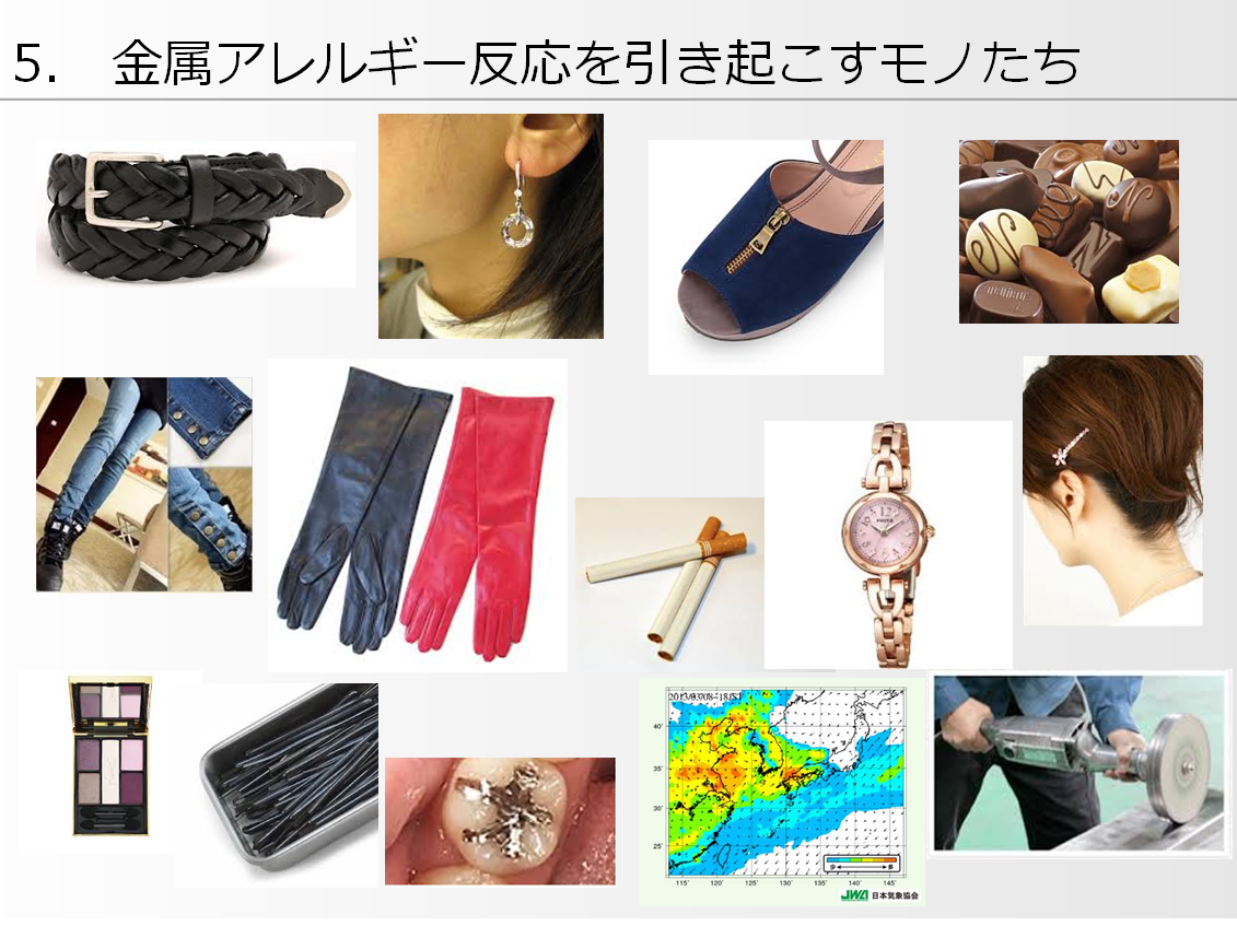＜金属アレルギー＞第4章：これって金属アレルギーなの？